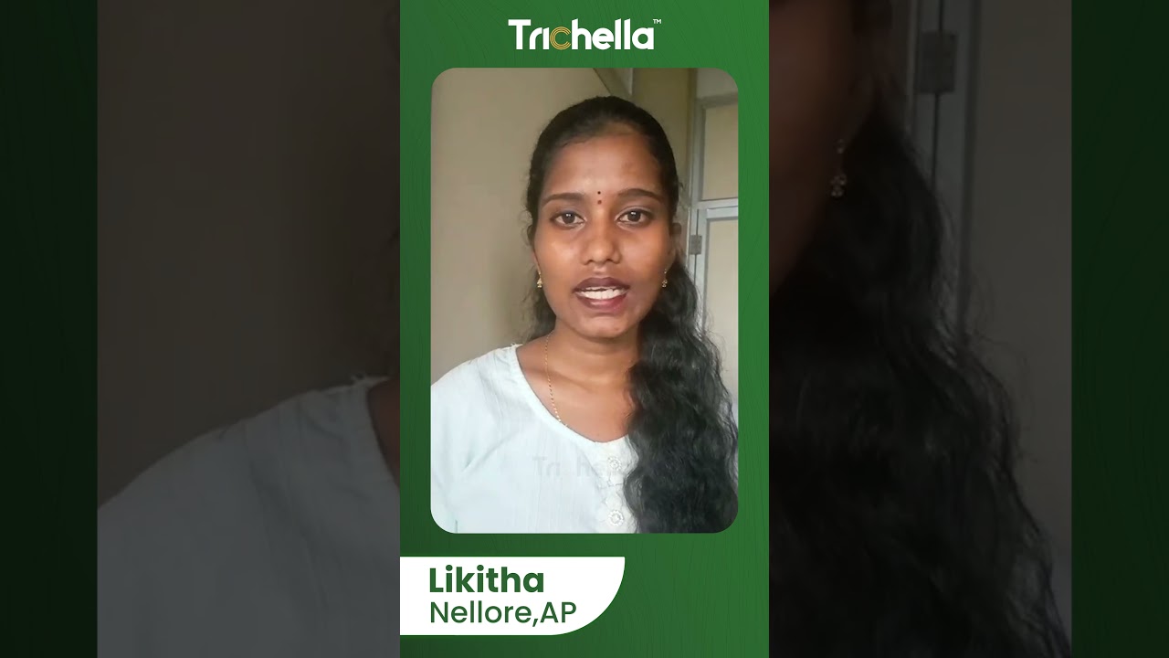 Real Hair Growth Results | Trichella User Experience & Hair Transformation Story
