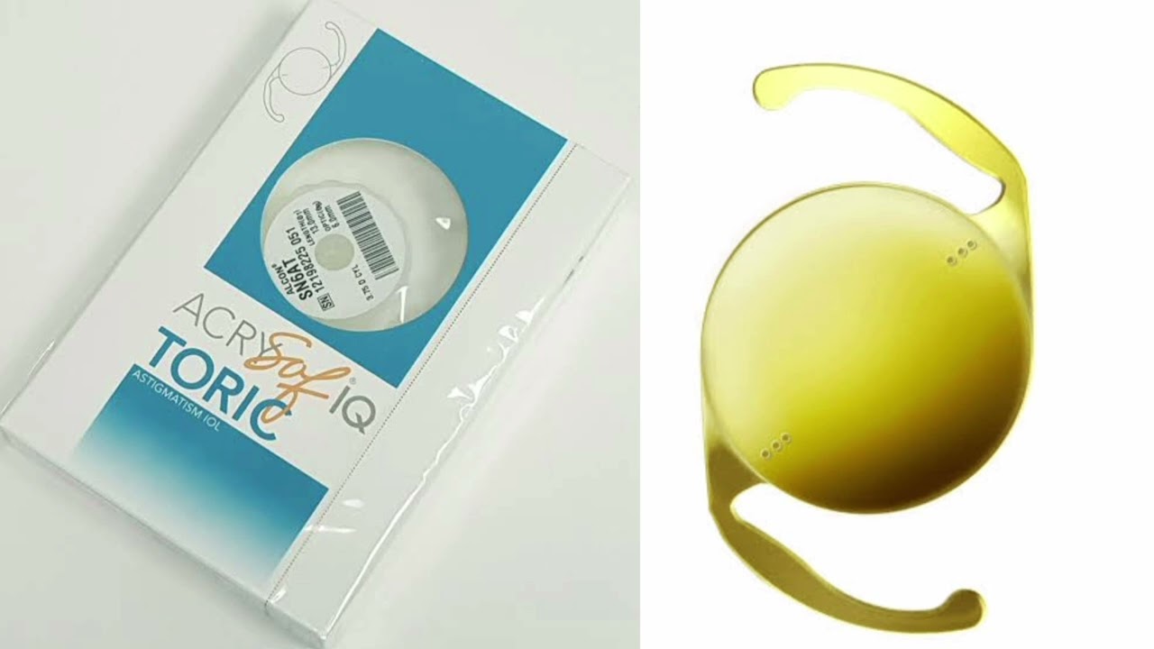 Cataract surgery with Toric lens