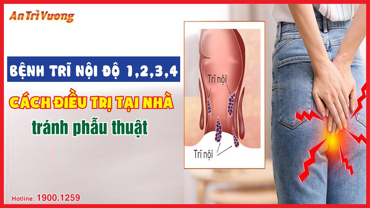 Bệnh trĩ nội độ 1,2,3,4 và cách điều trị tại nhà, tránh phẫu thuật | ATV | SV 01102023