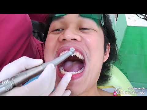 My tooth fairy (Dra. Haslaine P. Caunda)