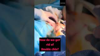 Want to get rid of a double chin?