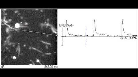 High-Speed Calcium Imaging of Isolated Mouse Atrial Cardiomyocytes
