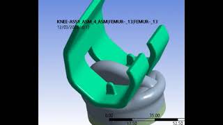 human knee replacement simulation in ansys for biomechanical design implant orthopedics