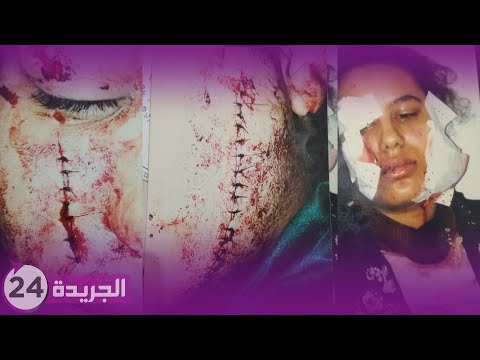 قصة مؤثرة تحكيها فتاة شرملها زوجها بعدما عجز عن فض بكارتها