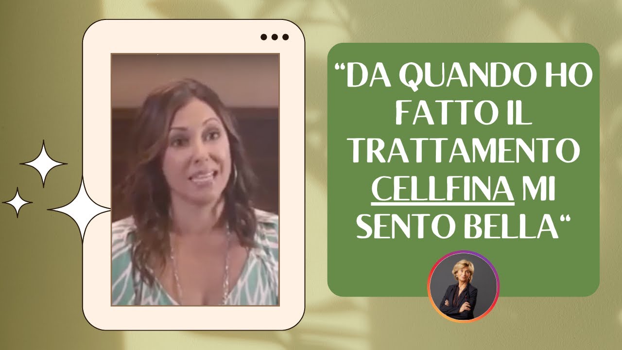 Cellfina Treatment testimonianza del paziente