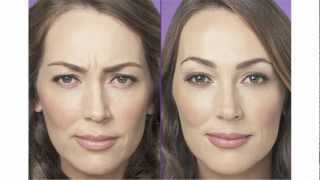 Dermal Injectables - Botox, Juvederm, Radiesse, Sculptra