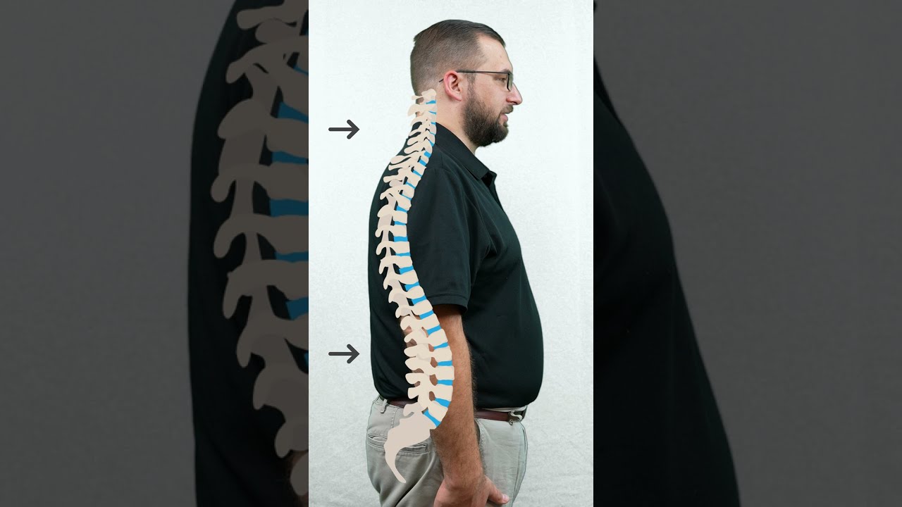 What Is The Natural Shape Of Spine 
