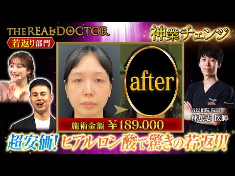 【切らない若返り】30歳代のお顔のたるみを改善して若返らせる東京の神業ドクター#湘南美容クリニック
