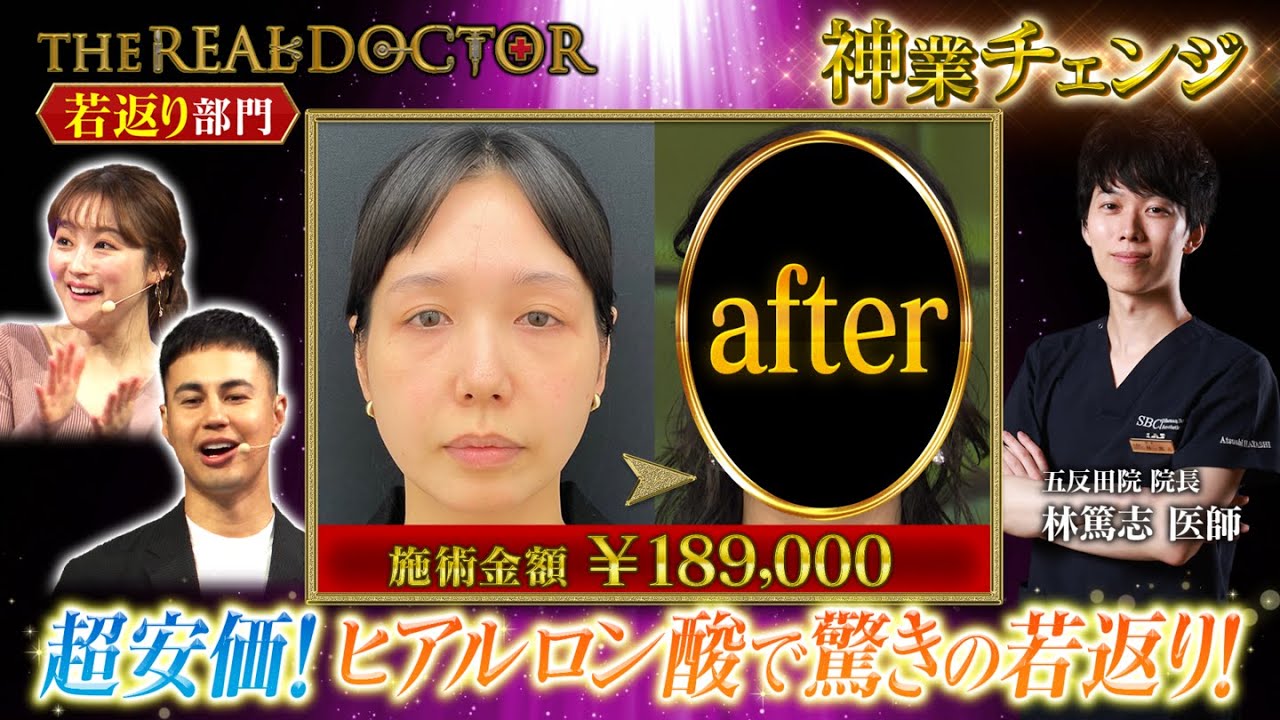 【切らない若返り】30歳代のお顔のたるみを改善して若返らせる東京の神業ドクター#湘南美容クリニック