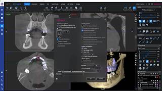 How to – Export CBCT images in DICOM format from Planmeca Romexis How to – Export CBCT images in DICOM format from Planmeca Romexis