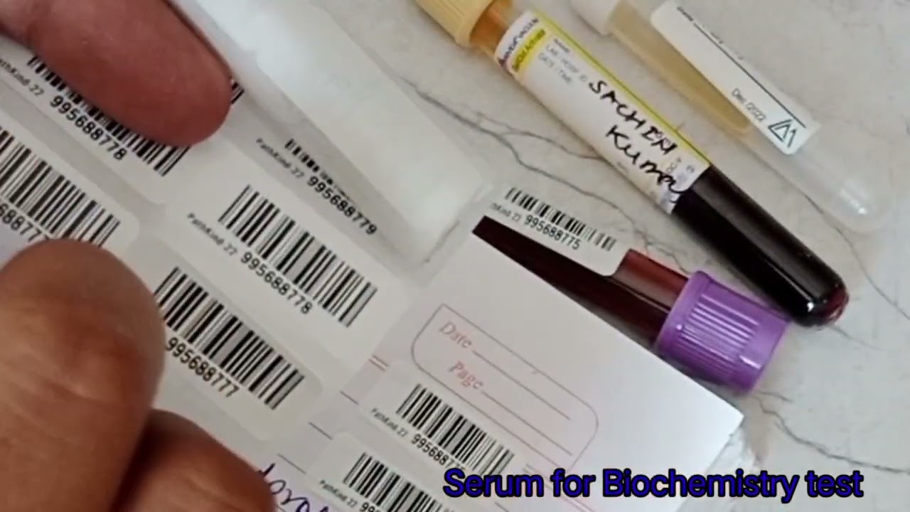 blood sample ready to send main lab 🧪🧪🧪 