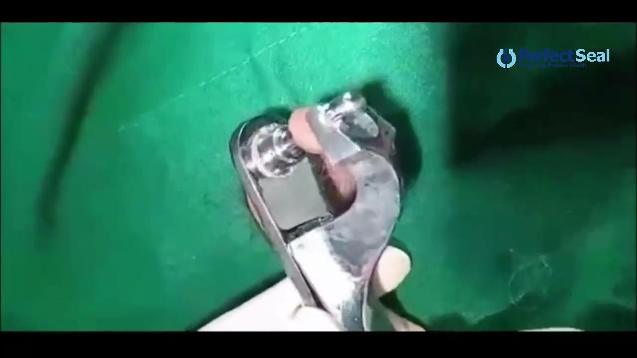 Circumcision PerfectSeal Skin glue or Stitches? YouTube