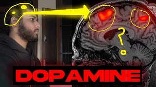 The Harsh Truth about Dopamine Detox NO ONE Tells YOU! screenshot 5