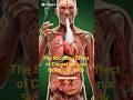 The Shocking Effect of Cigarettes on a Sickle Cell Body