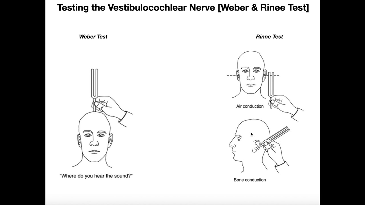 Interpreting the WeberRinne Tests EXPLAINED YouTube