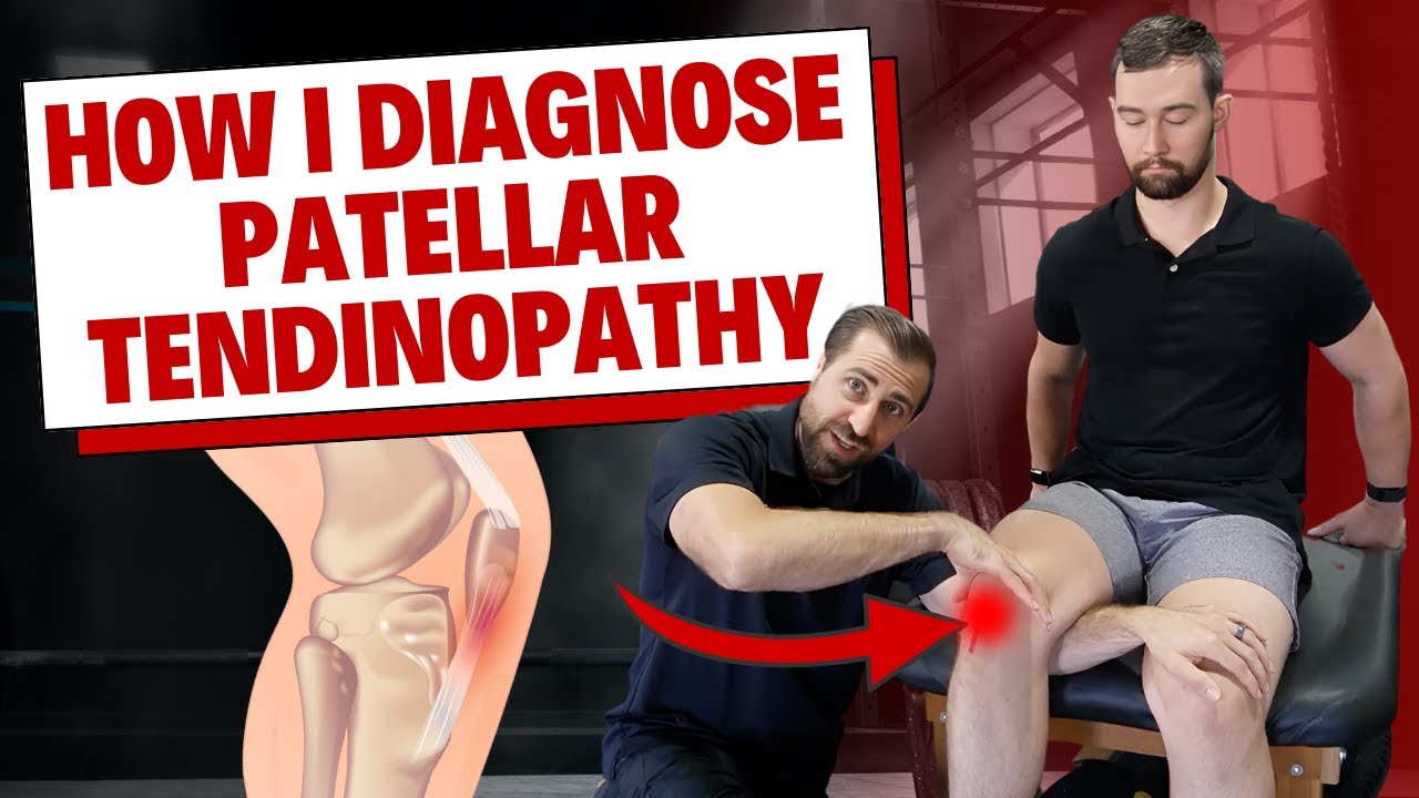 How I Diagnose Patellar Tendinopathy [Clinical Examination] - YouTube