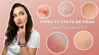 Comment connaître son type / état de peau  (Diagnostic, conseils et astuces)