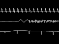 C64 Rob Hubbard's "Lightforce" Oscilloscope view