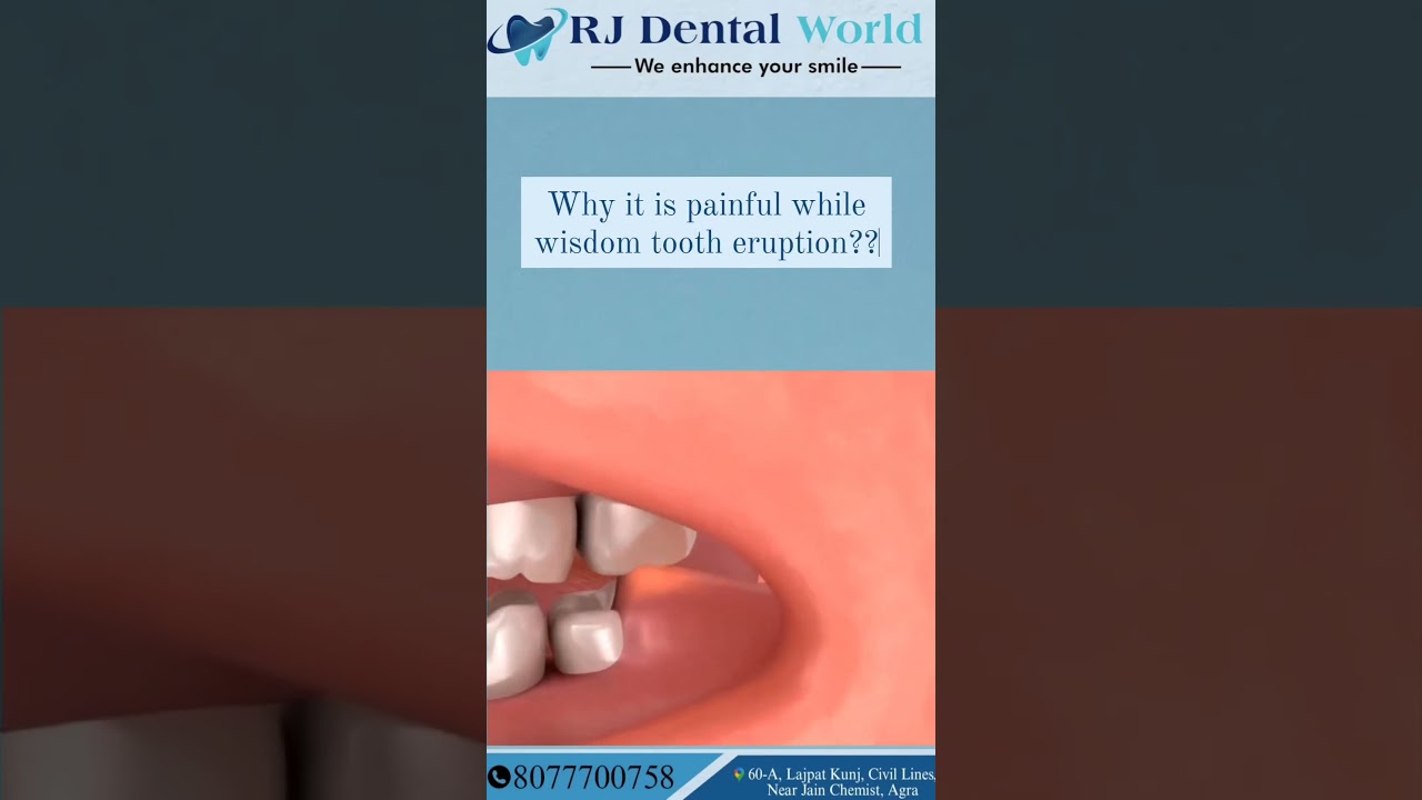 Reason of pain while third molar tooth eruption | pain while wisdom tooth eruption