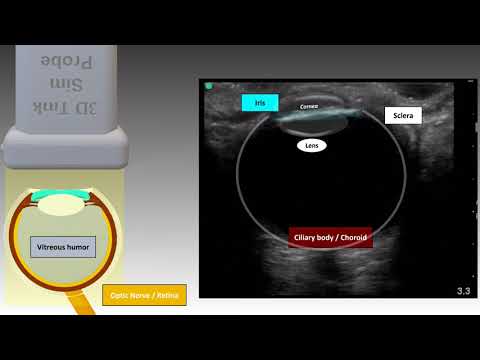POCUS Orbital Anatomy