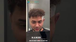 How Ear Surgery Changes the Whole Face (Live Result)