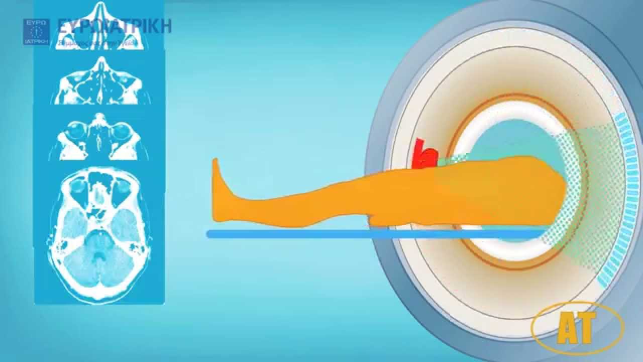 Προετοιμασία πριν την Εξέταση της Αξονικής Τομογραφίας