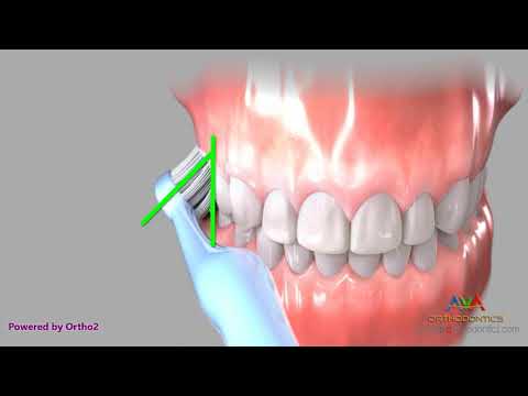 Brushing with Manual Toothbrush - Bass Technique