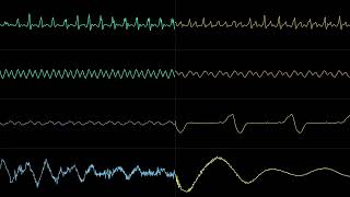 Chrono Trigger - Fanfare 1 ~ Lucca's Theme [Oscilloscope View]