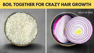 Boil Rice 🍚 + Onion 🧅 | HAIR GROWS LIKE CRAZY ✔ Strengthens Hair and Prevents Hair Loss