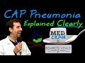 Community Acquired Pneumonia (CAP) - Exam Practice Question