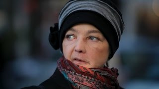 Face transplant patient dies in France