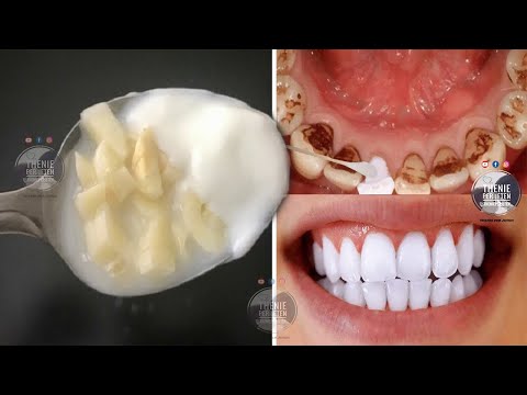 Video: Si të pastroni një furçë dhëmbësh elektrike