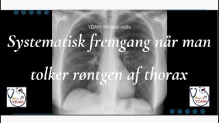 Systematisk fremgang når man tolker rtg. thorax - YDAMs kliniske skills
