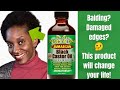 JAMAICAN BLACK CASTOR OIL(ROSEMARY) WILL GROW BACK YOUR EDGES IN LESS THAN 2 MONTHS!!!!