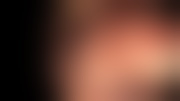 Cecal LST-G EMR/EFTR