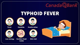 Typhoid Fever by CanadaQBank 867 views 1 month ago 6 minutes, 33 seconds