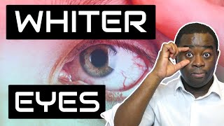 Why you don&#39;t have whiter eyeballs