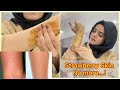 How To Get A Rid Of Strawberry Skin | Smooth Skin After Wax | Dietitian Aqsa