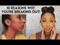 10 Reasons Why You're Breaking Out! Acne Tips! | BiancaReneeToday