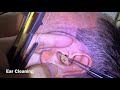 Close up of ear cleaning