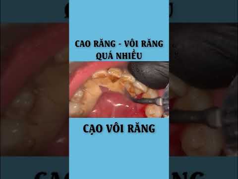 Video: Đảo rác thái bình dương