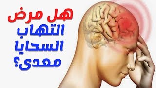 هل مرض التهاب السحايا معد؟وماهي اعراضه وطرق علاجه؟