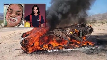 Aspiring firefighter suffers extreme burns in freak dune buggy accident