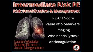 Ep 203 Intermediate Risk Pulmonary Embolism Risk Stratification, Management and Algorithm