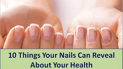 10 Things Your Nails Can Reveal About Your Health - Everyday Health