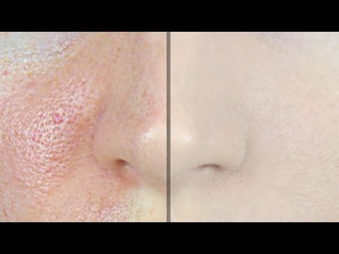 How to Make Pores Disappear! | STEPHANIE LANGE