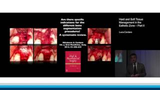 Hard and Soft Tissue Management in the Esthetic Zone – Part II | Luca Cordaro screenshot 2