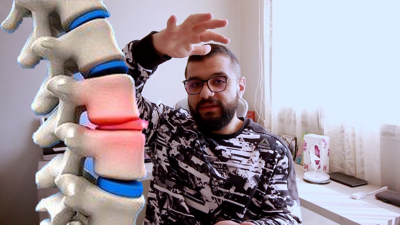 علاج اصابة الدسك - الفتق في الظهر