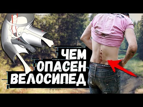 Все о велосипедных травмах: как мы их получаем и как их избежать