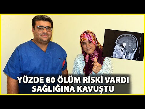 Beynindeki Milyonda Bir Görülen Tümör, Ameliyatla Alındı